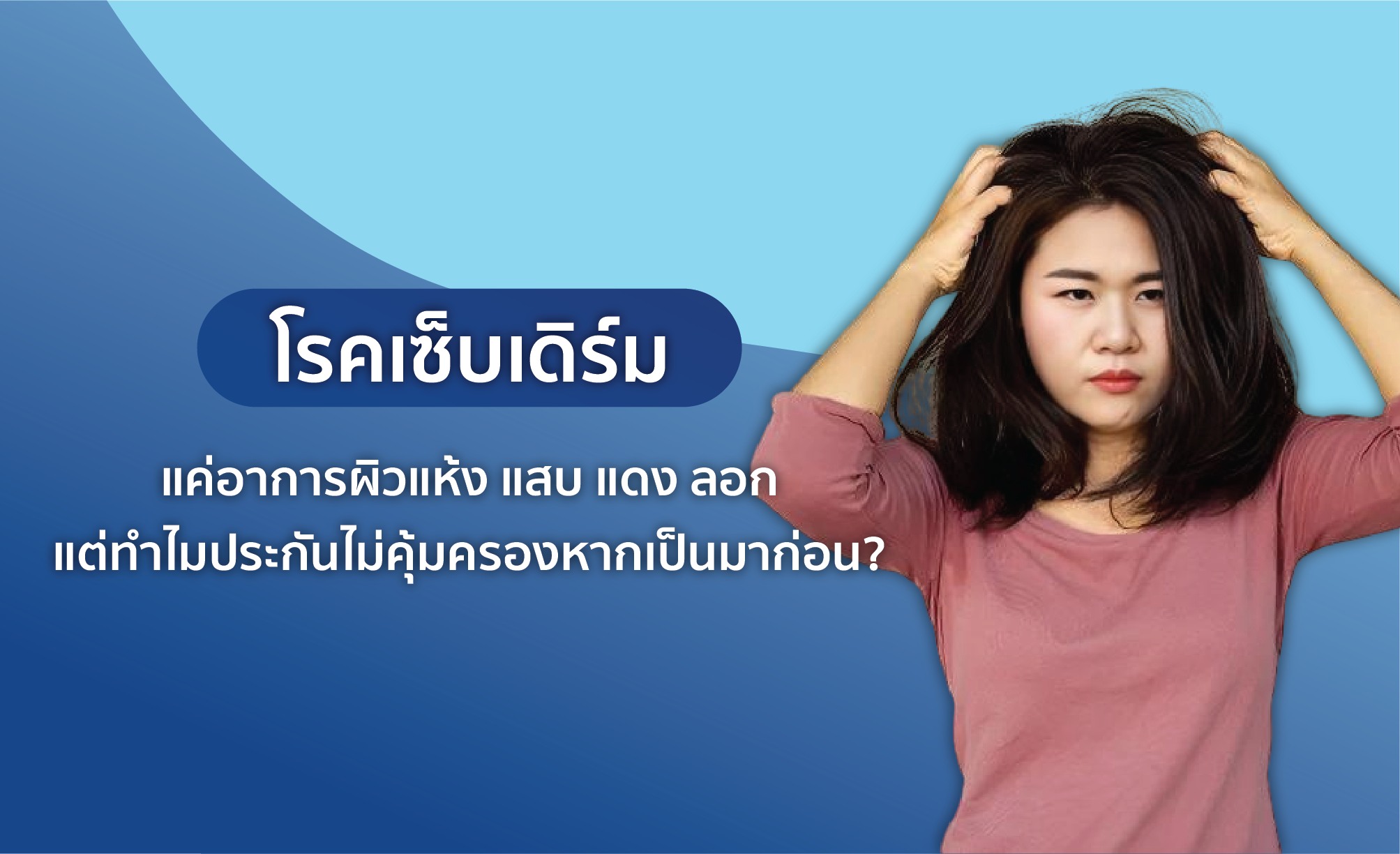 เซ็บเดิร์ม โรคภูมิแพ้ที่ชื่อน่ารักแต่อันตรายกว่าที่คิด